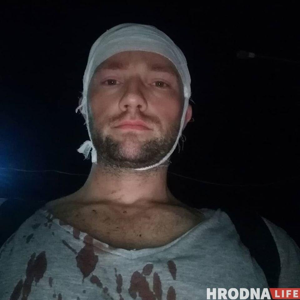 «Пришлось удалить глаз», «бросали головой вниз», «на спине табличка в крестики-нолики». Медики из Гродно — о травмах пострадавших от ОМОНа