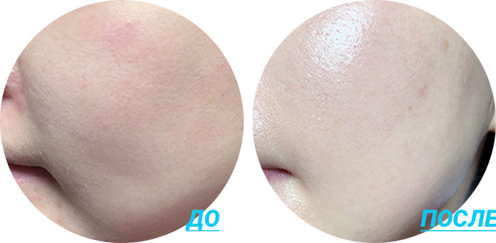 //cdn.optipic.io/site-2009/catalog/ukhod-dlya-litsa/krem-dlya-litsa/medi-peel-krem-s-peptidnymi-kapsulami-power-aqua-cream-50-ml/Medi-Peel-Blue-Aqua-Tox-Cream-2.jpg //cdn.optipic.io/site-2009/catalog/ukhod-dlya-litsa/krem-dlya-litsa/medi-peel-krem-s-peptidnymi-kapsulami-power-aqua-cream-50-ml/Medi-Peel-Blue-Aqua-Tox-Cream-2.jpg