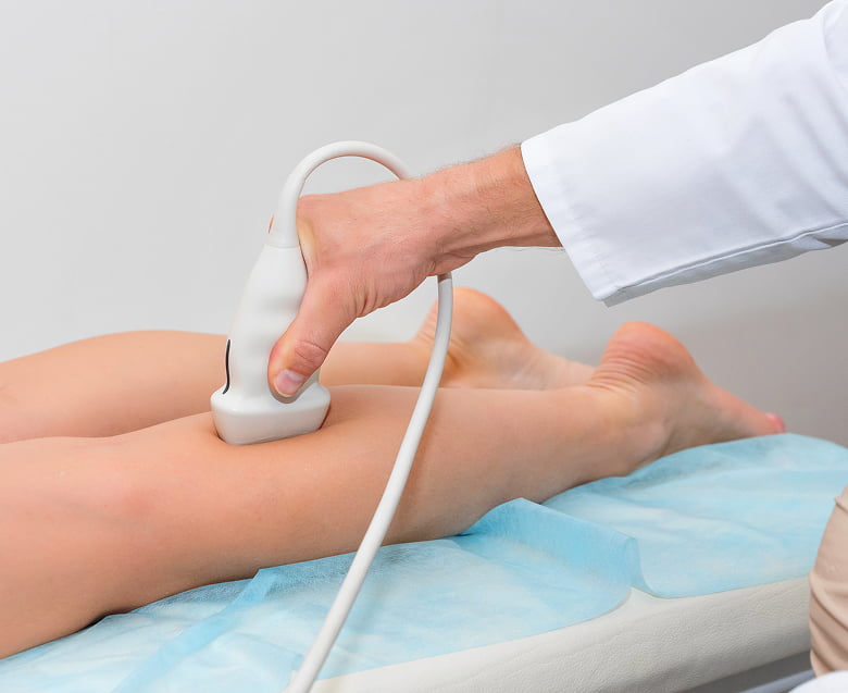 УЗИ вен нижних конечностей