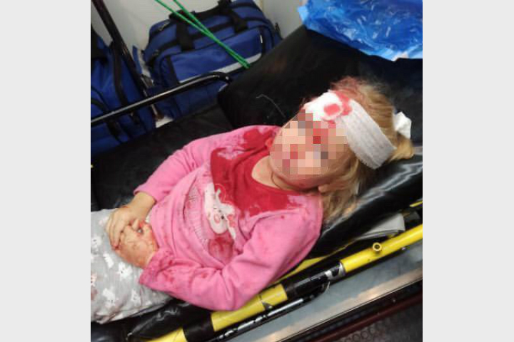 «Мама, на нас напали бандиты?» В Гродно во время акции протеста пострадала пятилетняя девочка