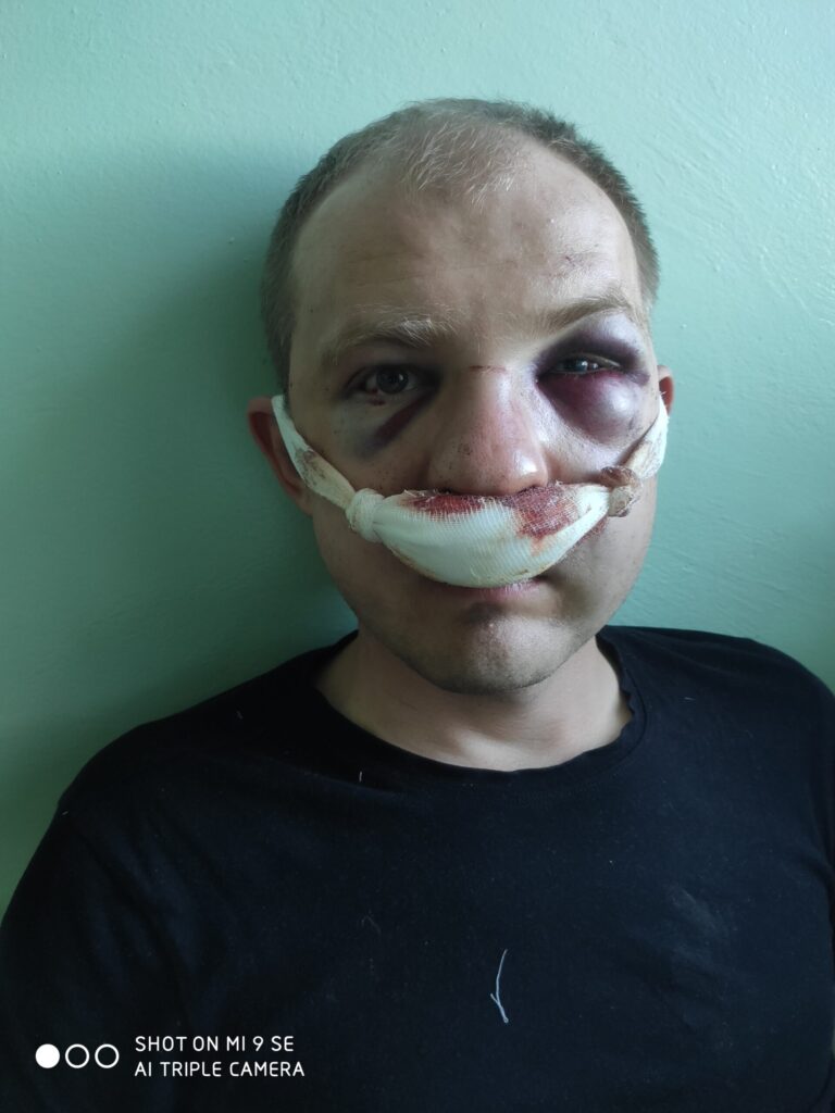 «Только один выбор – бежать». Таксист из Гродно рассказал, почему не пришел в суд и как оказался в Литве