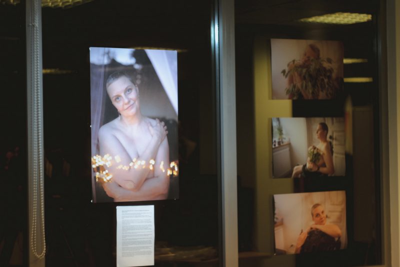 «Про рак. Истории белорусок». Фотовыставку о женщинах, которые проживают рак груди, открыли в Вильнюсе