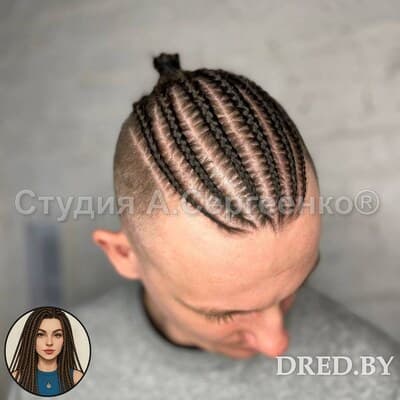 Мужские брейды на теменную зону, вид сбоку, Минск