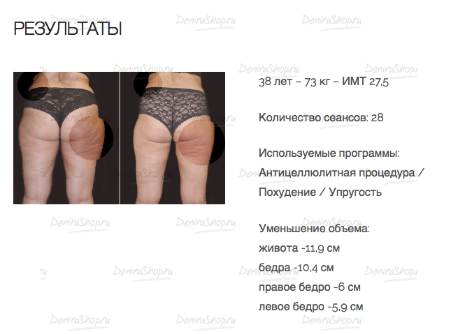 Кушетка Gharieni Celliss картинки Gharieni Gharieni Celliss