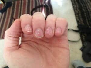 1. Что значат белые пятна на ногтях — или ничего не значат