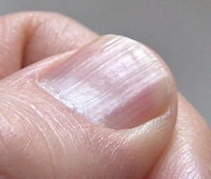 Ногти — «зеркало» внутреннего состояния организма