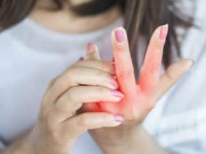 Причины зуда и шелушения пальцев