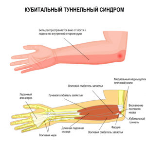 Диагностика заболевания