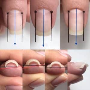 Коррекция ногтя