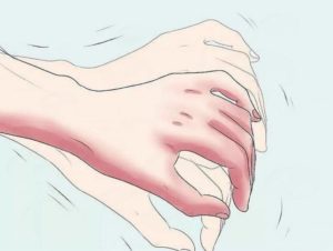 Причины тремора рук