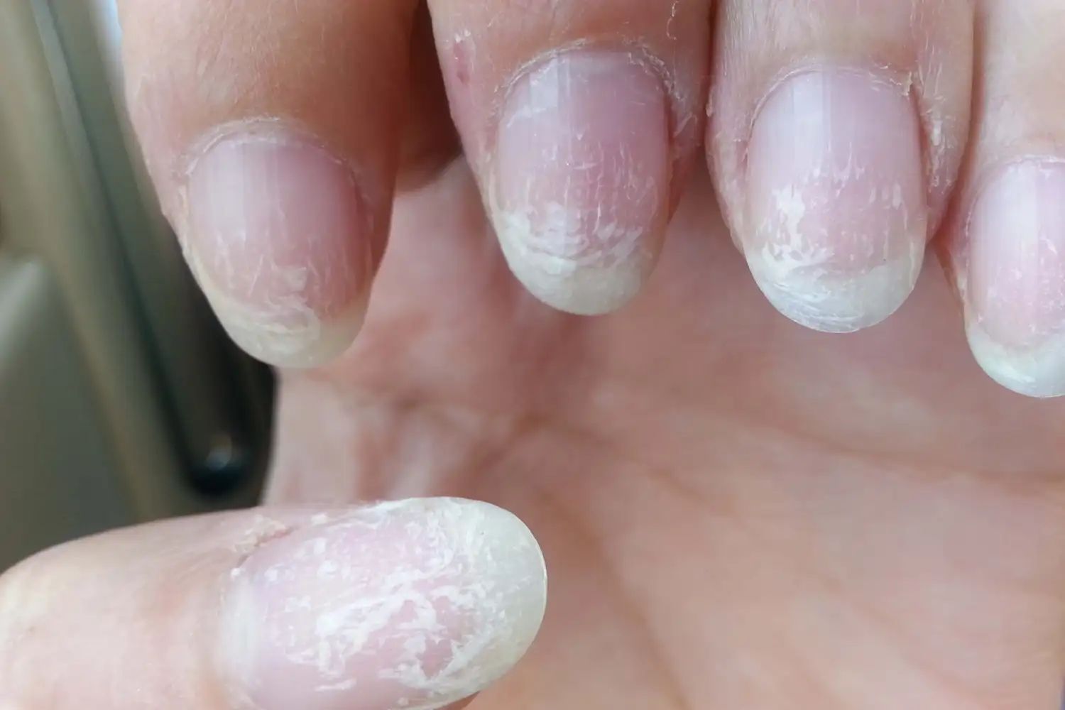 Последствия неправильного ухода за ногтями – как их избежать