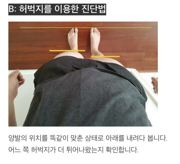 골반 틀어짐 자가 진단법