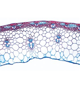 AngioSperma IV. Tulpini - diapozitive germane