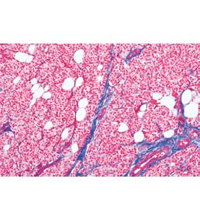 Histologie umană normală, set mare, partea a II -a. - Limba franceza