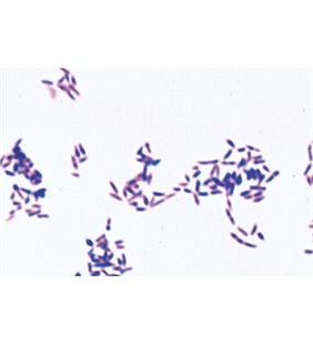 Bacterii patogene - diapozitive germane