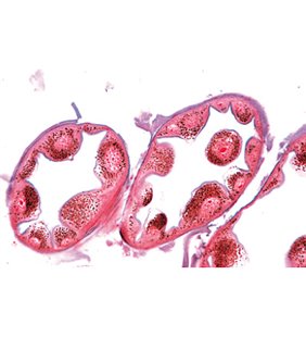 Seria II. Metabolism - diapozitive englezești