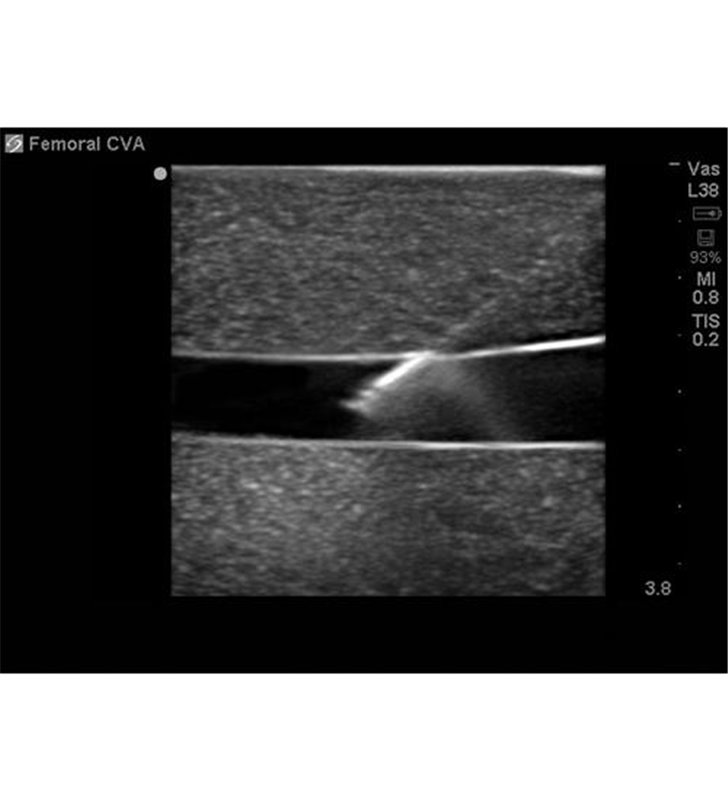Țesut de înlocuire a accesului vascular femural pentru BPP-031 până la BPP-036 Blue Phantom