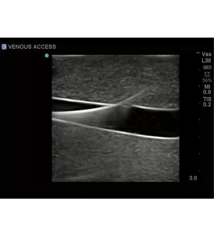 Țesut de înlocuire a accesului vascular femural pentru BPP-031 până la BPP-036 Blue Phantom