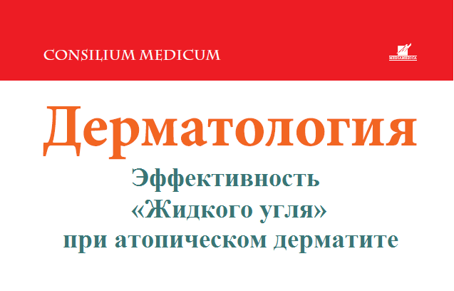 Опубликованы результаты клинического исследования эффективности «Жидкого угля» при атопическом дерматите