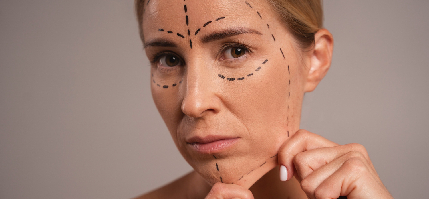 Как ухаживать за кожей с деформационным типом старения?