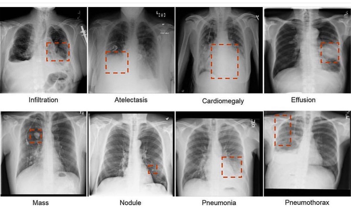 Что можно увидеть с помощью рентгена?