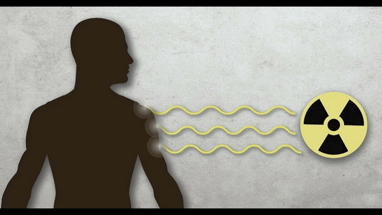 Как вывести радиацию после рентгена