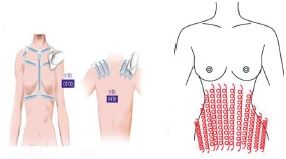 //cdn.optipic.io/site-106815/issues/instruktsiya-po-rabote-s-apparatom-sa-v9/SA-V9 9.jpg