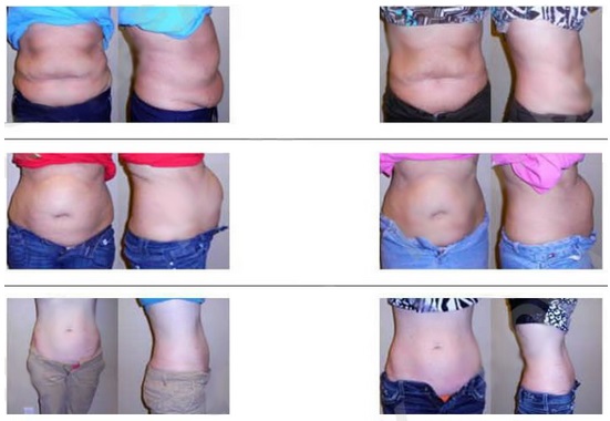 //cdn.optipic.io/site-106815/issues/instruktsiya-po-rabote-s-apparatom-nv-l650/тмд650 5.jpg