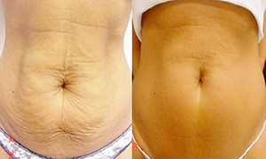 //cdn.optipic.io/site-106815/issues/radiolifting/RF 3 мал.jpg