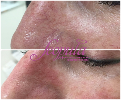 //cdn.optipic.io/site-106815/issues/instruktsiya-po-rabote-s-apparatom-sa-980/SA-980 (2).jpg