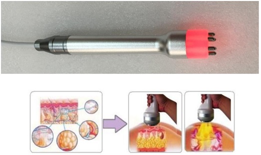 //cdn.optipic.io/site-106815/issues/instruktsiya-po-rabote-s-apparatom-bm-002/BM-002 4.jpg