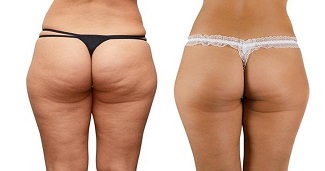 //cdn.optipic.io/site-106815/issues/instruktsiya-po-rabote-s-apparatom-nv-600/vacuum 2.jpg