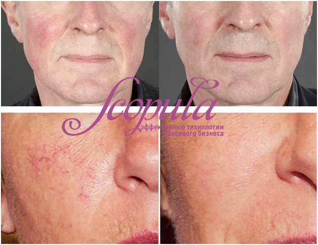 //cdn.optipic.io/site-106815/issues/instruktsiya-po-rabote-s-apparatom-sa-980/SA-980 (3).jpg