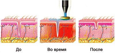 //cdn.optipic.io/site-106815/issues/radiolifting/RF 5 мал.png