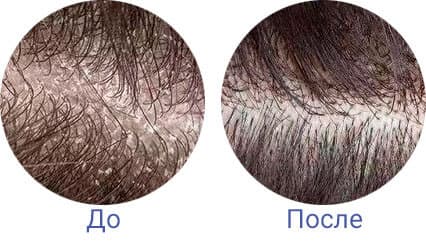 //cdn.optipic.io/site-2009/catalog/dlya-volos/masil-ochishchayushchiy-loson-dlya-kozhi-golovy-12-scalp-spa-cleansing-lotion/MASIL-12-Scalp-Spa-Cleansing-Lotion-4.jpg