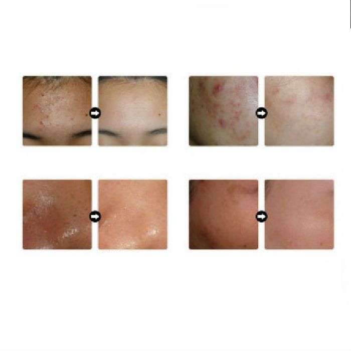Крем для лица с муцином улитки 15мл MIZON All In One Snail Repair Cream Mini