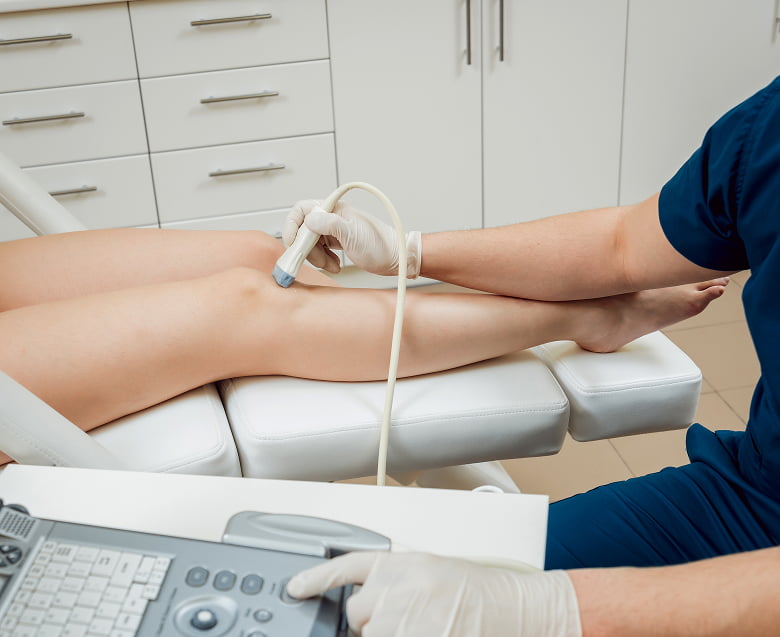 УЗИ сосудов