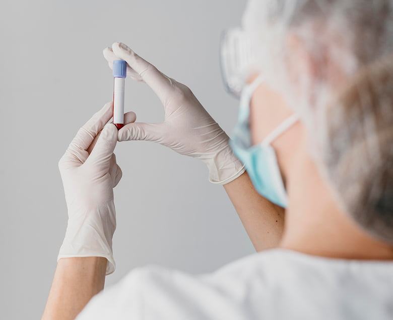 Исследование системы гемостаза