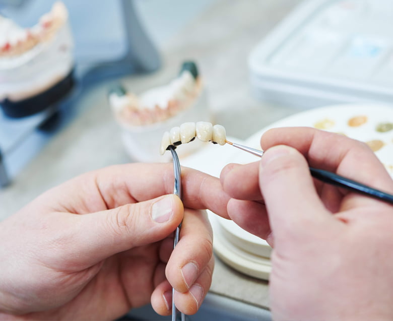 Несъемные зубные протезы