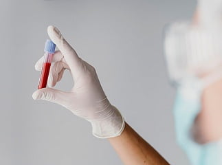 Что входит в комплекс и для чего нужен каждый показатель